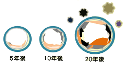 5年後・10年後・20年後の配管の様子